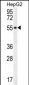 UXS1 Antibody (C-term)
